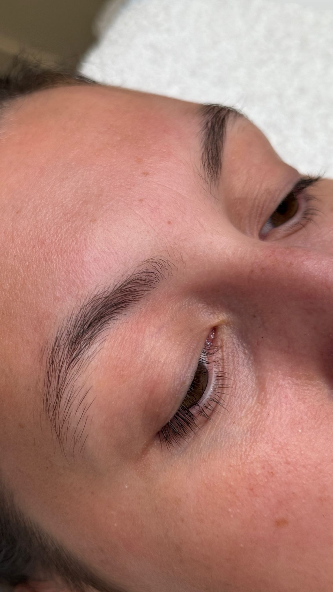 Before brow treatment